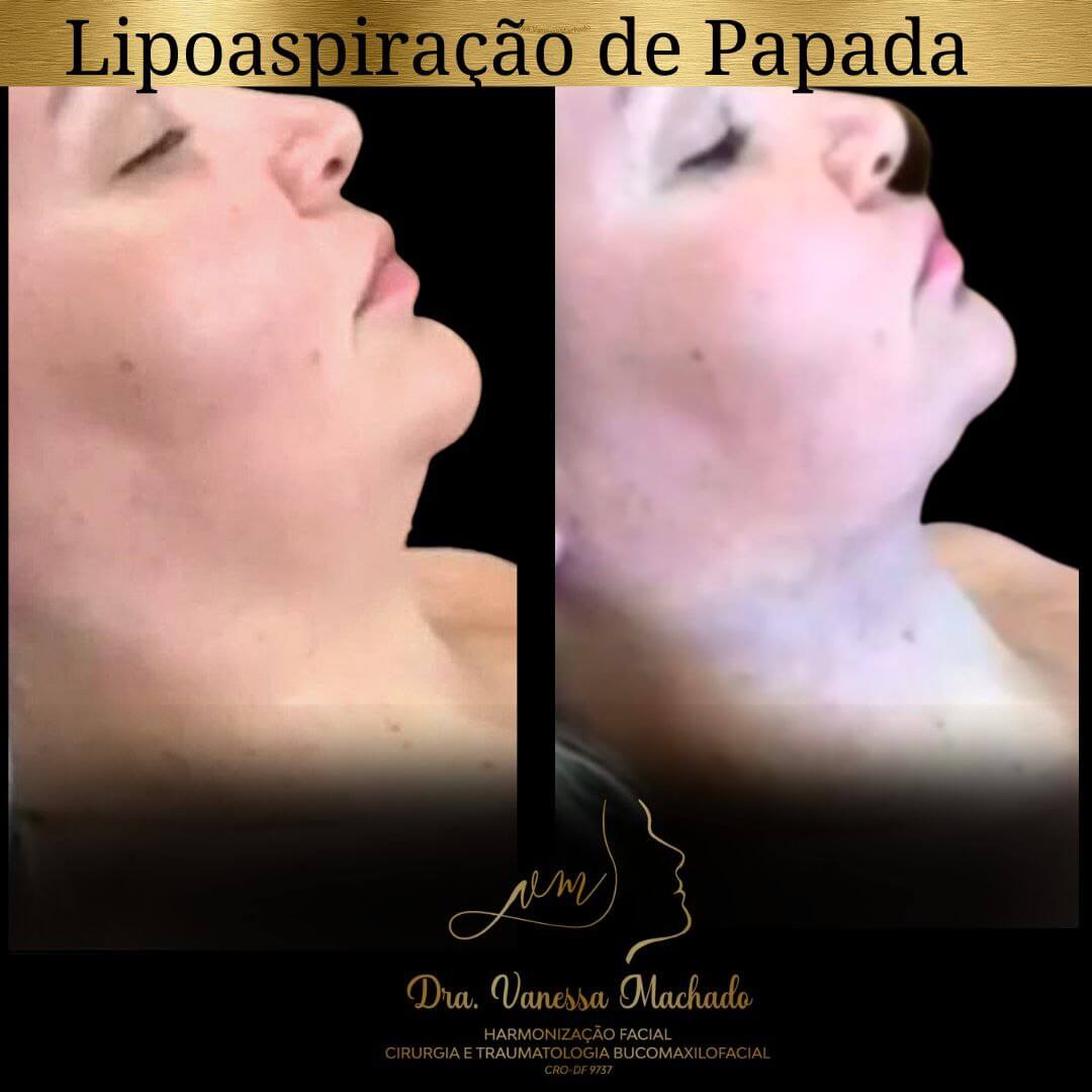 photo_4934046588876204825_y-1