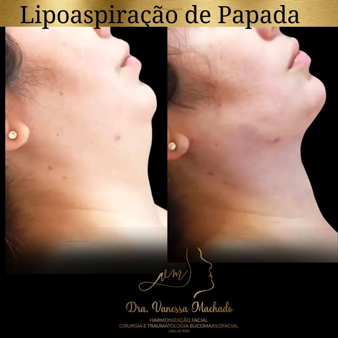 photo_4934046588876204826_y-1