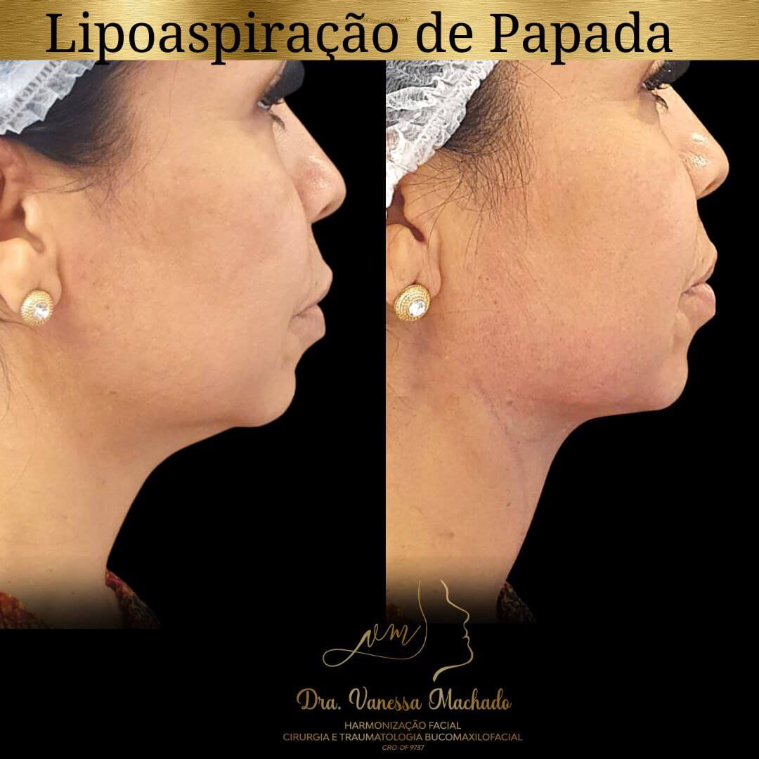 photo_4934046588876204827_y-1