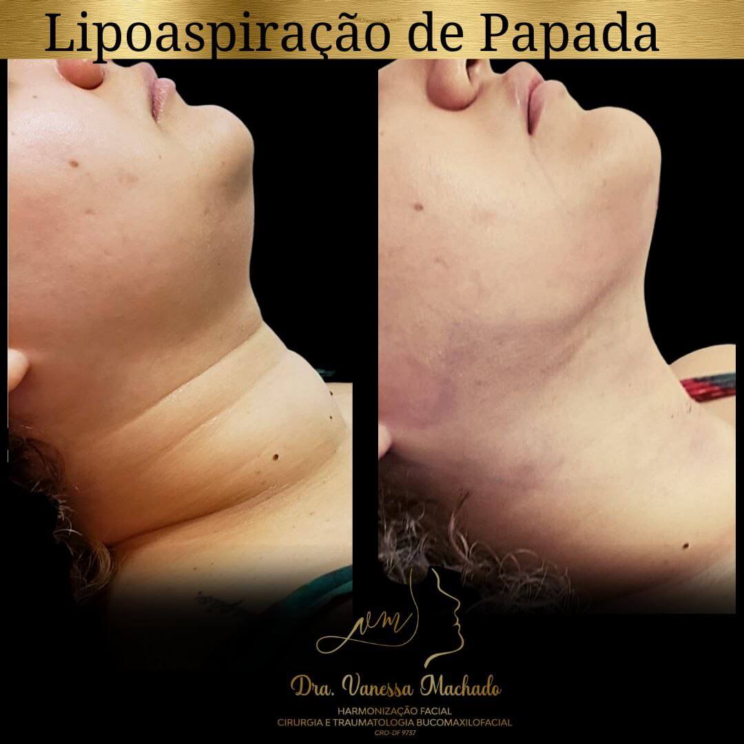 photo_4934046588876204828_y-1