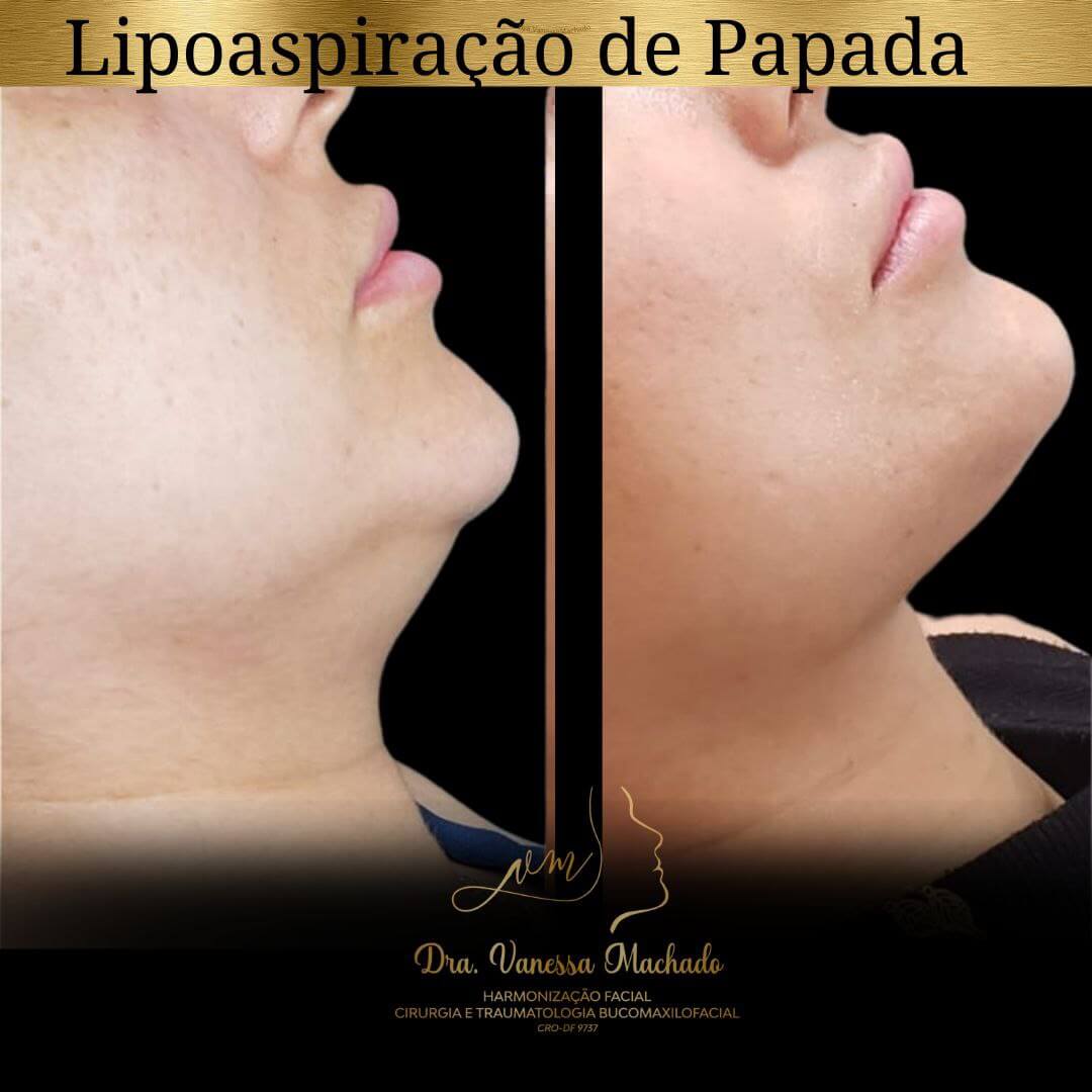 photo_4934046588876204829_y-1