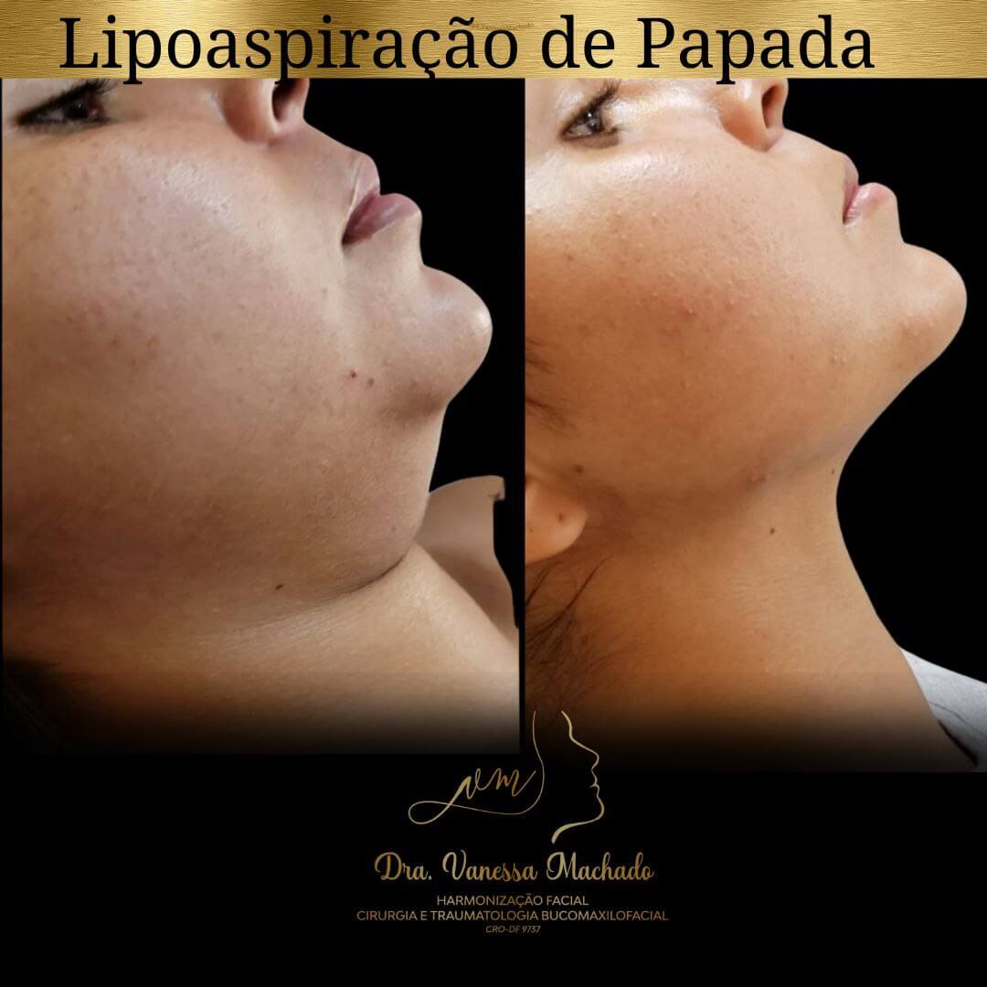 photo_4934046588876204830_y-1