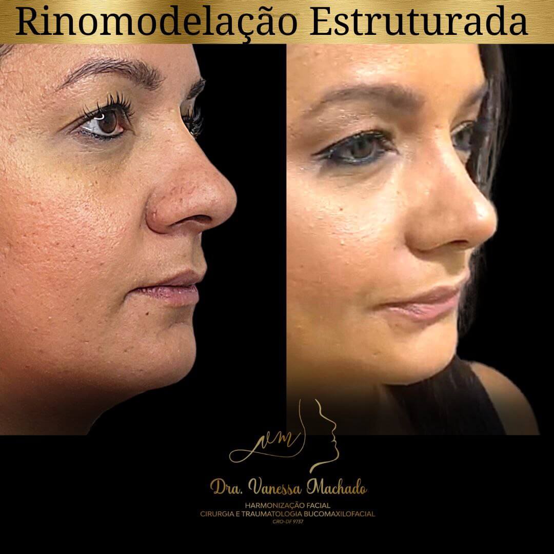 photo_4934046588876204837_y-1