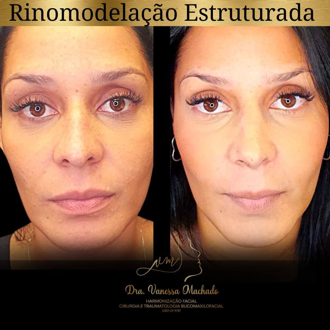 photo_4934046588876204839_y-1