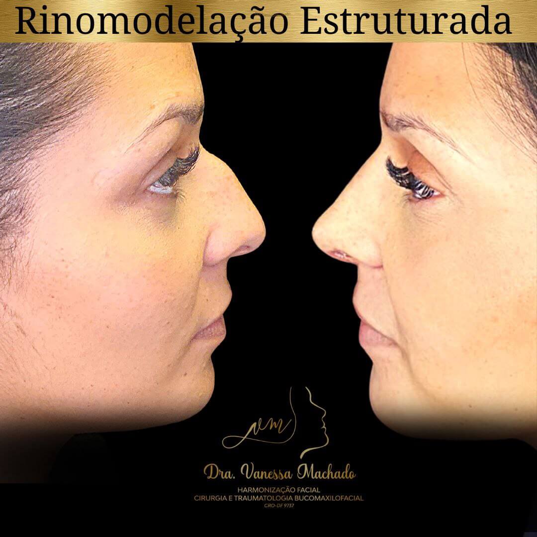 photo_4934046588876204840_y-1