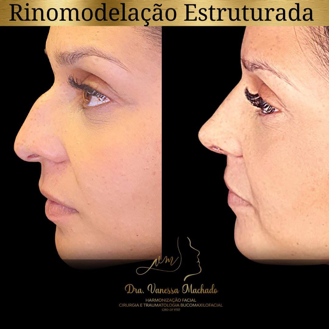 photo_4934046588876204842_y-1