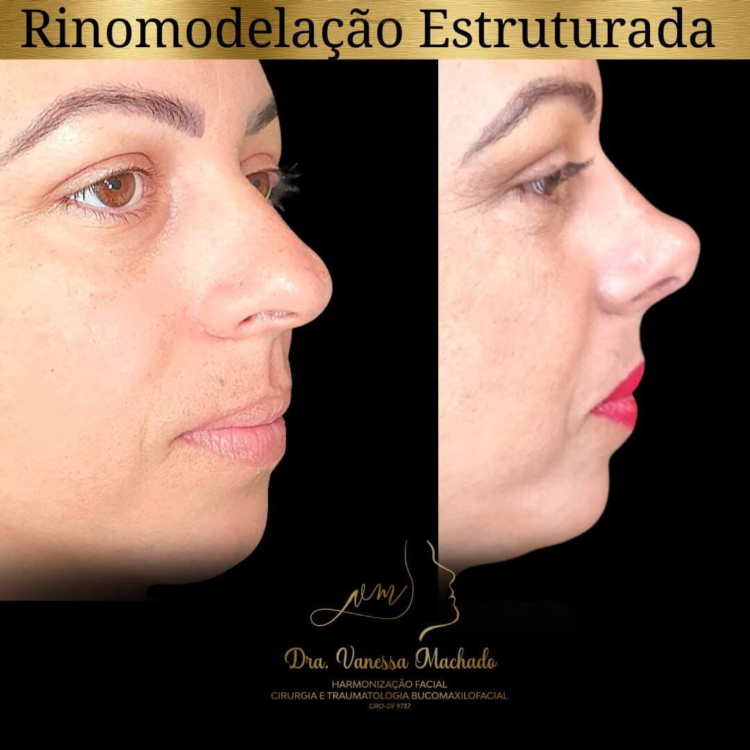 photo_4934046588876204843_y-1