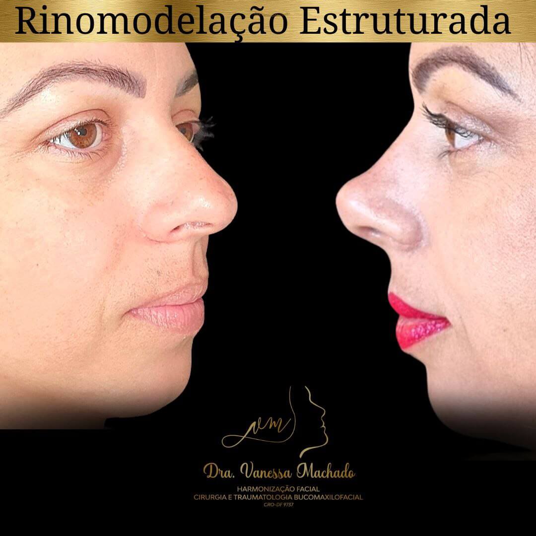 photo_4934046588876204844_y-1