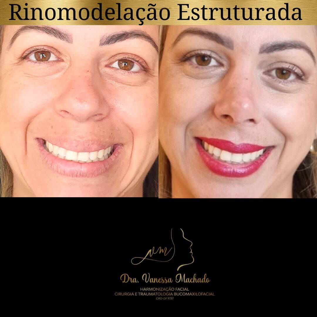 photo_4934046588876204845_y-1