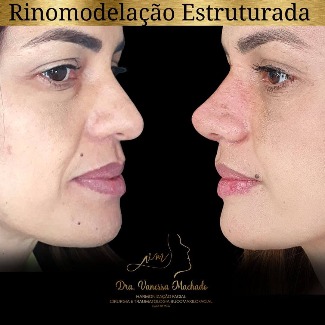 photo_4934046588876204847_y-1