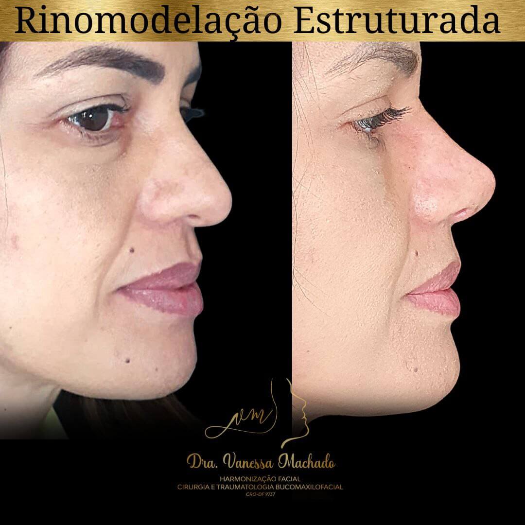 photo_4934046588876204848_y-1