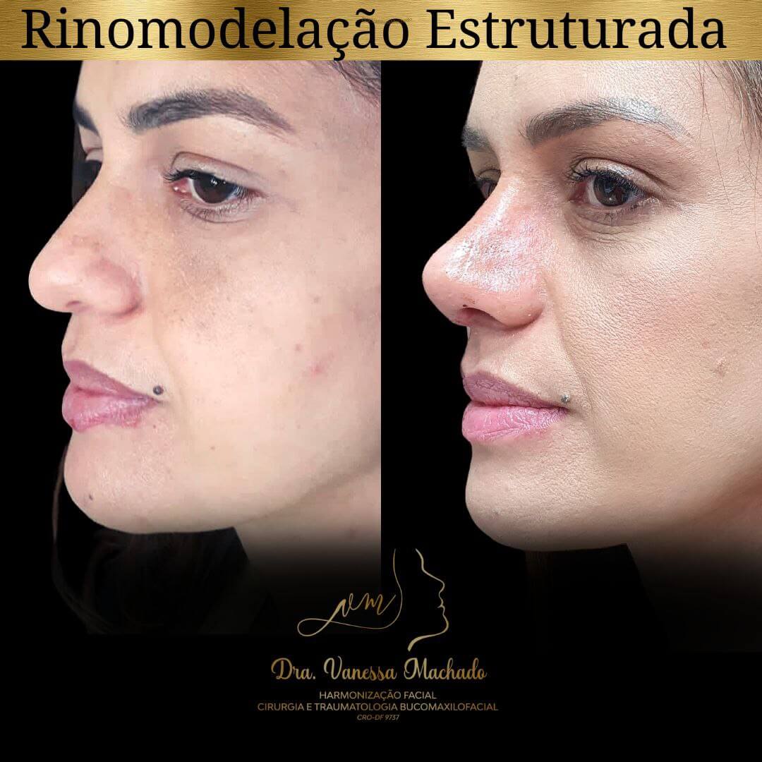 photo_4934046588876204849_y-1