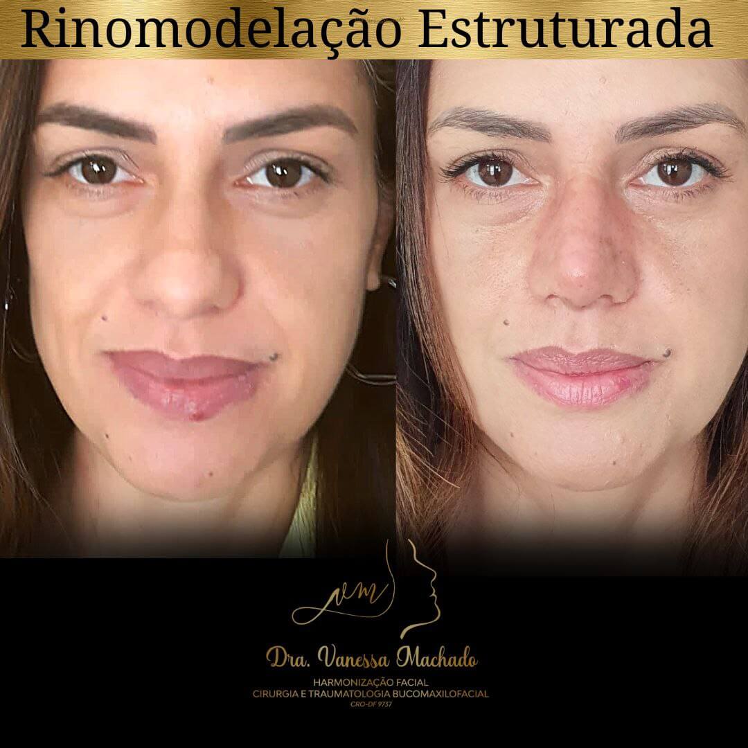 photo_4934046588876204850_y-1