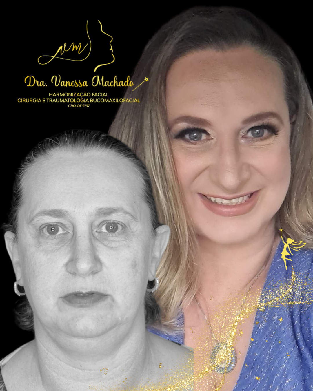 PROTOCOLO DE EMAGRECIMENTO FACIAL