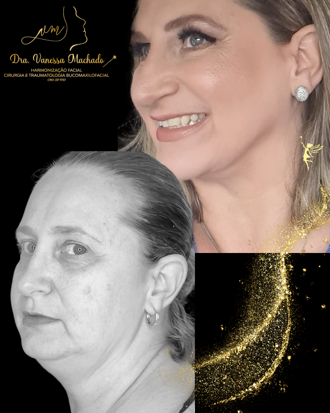 PROTOCOLO DE EMAGRECIMENTO FACIAL